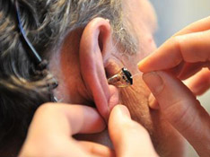 Adaptation des appareils auditifs par l'audioprothésiste