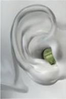 Appareil auditif intra auriculaire 