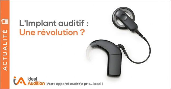 Implant Auditif Nouveautés 