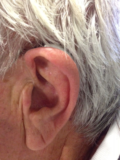 Modèle d'appareil auditif contour d'oreille 