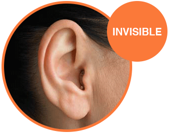 Appareil auditif invisible