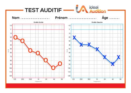 Bilan auditif pour mesurer l'audition 