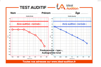 Audiogramme tonal