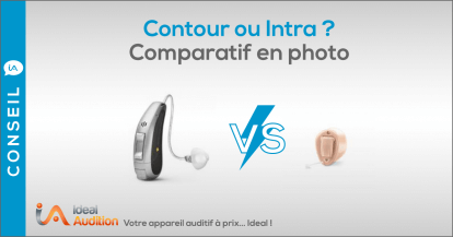 Appareil auditif contour ou intra ? Comparatif en photo