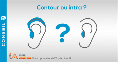 Choix d'une prothèse auditive contour ou intra ?