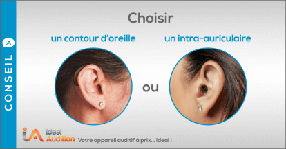 Choix du contour ou de l'intangibilité-auriculaire