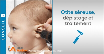 Otite séreuse : une infection de l'oreille à prendre au sérieux 