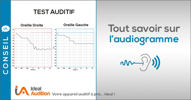 L'audiogramme : résultat du test auditif 