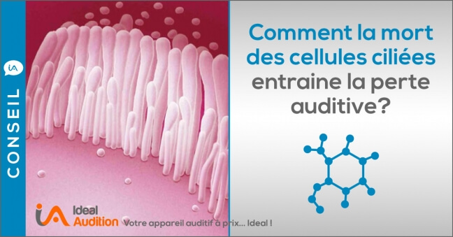 Agression sonore et cellules ciliées : prudence ! - Ideal Audition