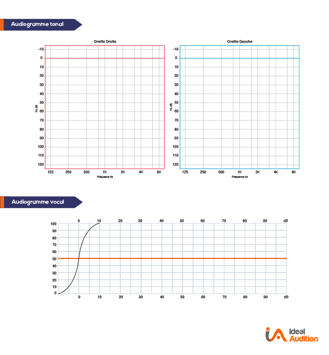 Audiogramme tonal et vocal